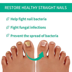 Nail Fungus Solution, Anti Infection Nail Fungus Removal Gel, Ingrown Toenail Treatment Nail Care Oil, Nail Fungus Treatments Serum